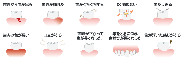 歯周病の進行